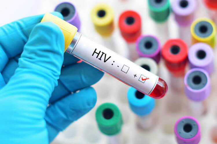 آزمایش HPV