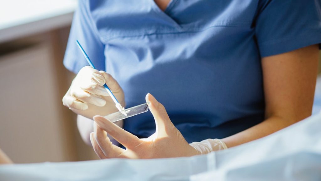 عفونت بعد از لیزر زگیل تناسلی