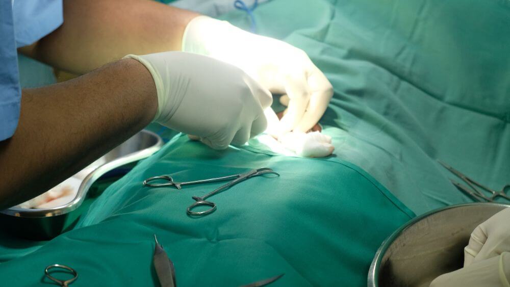 اصلاح ختنه بد