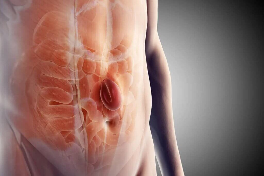 فتق روده چیست