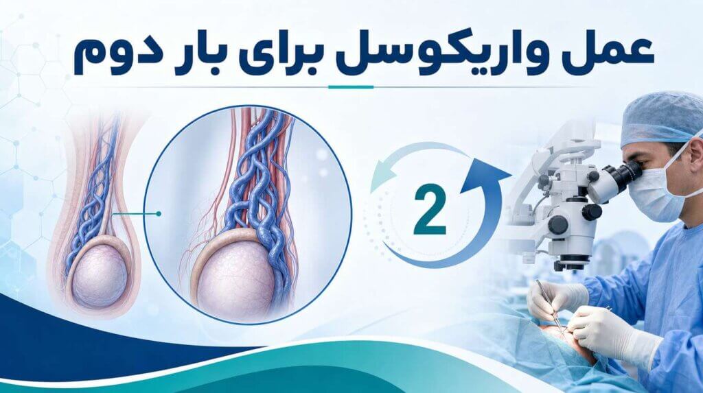 عمل واریکوسل برای بار دوم